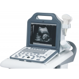 Diagnostic Ultrasound