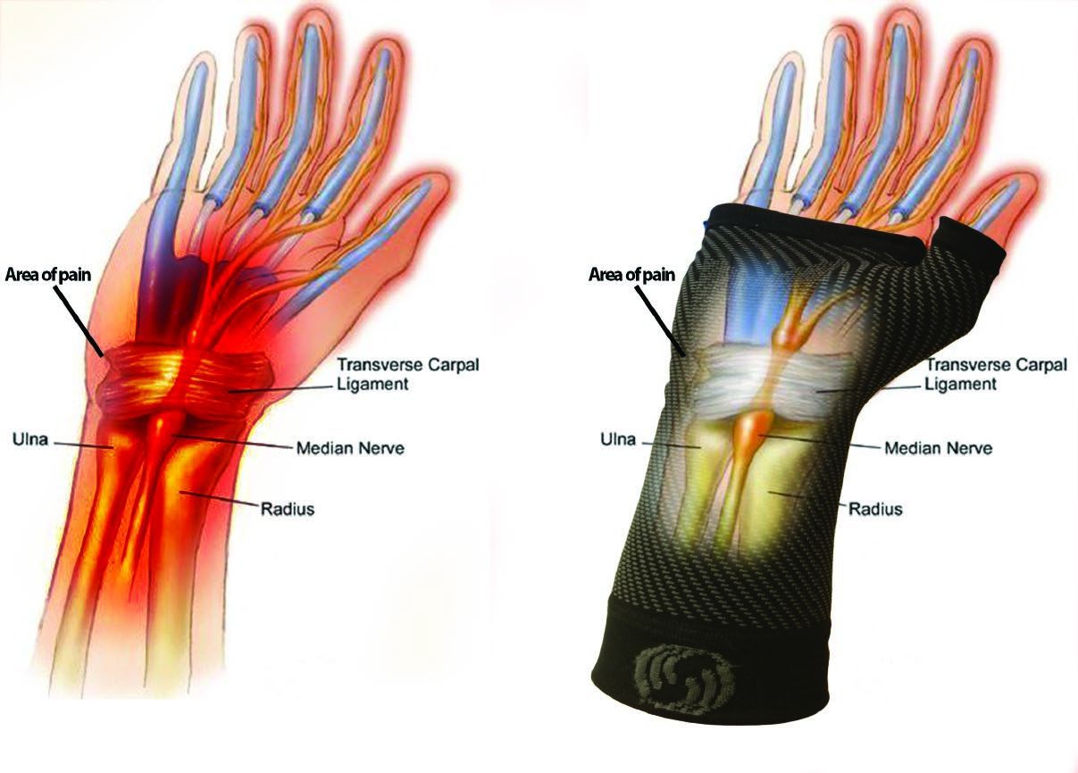OS1 WRIST PERFORMANCE SLEEVE / BLACK photo