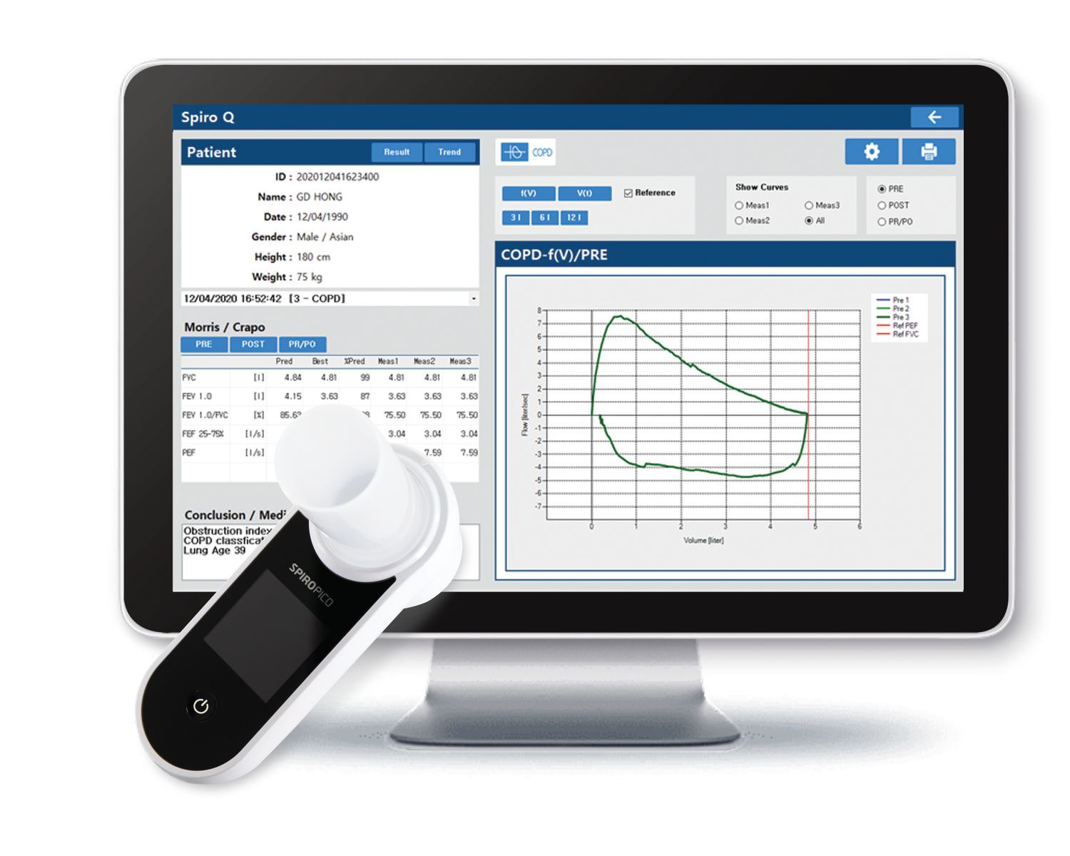 BOST VITAFLOW DELUXE PORTABLE SPIROMETER  AND MOUTHPIECE photo