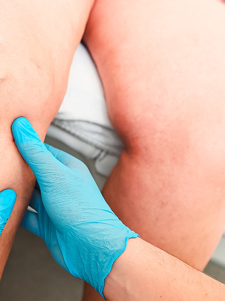 Lymphedema